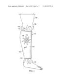 DRESSINGS, SYSTEMS, AND METHODS FOR TREATING A WOUND ON A PATIENT S LIMB     EMPLOYING LIQUID CONTROL diagram and image