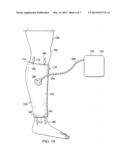 DRESSINGS, SYSTEMS, AND METHODS FOR TREATING A WOUND ON A PATIENT S LIMB     EMPLOYING LIQUID CONTROL diagram and image