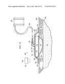 MEDICAL DRESSINGS, SYSTEMS, AND METHODS WITH THERMALLY-ENHANCED VAPOR     TRANSMISSIONS diagram and image