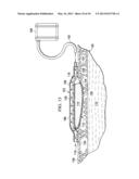 MEDICAL DRESSINGS, SYSTEMS, AND METHODS WITH THERMALLY-ENHANCED VAPOR     TRANSMISSIONS diagram and image