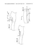 DISSECTION HANDPIECE AND METHOD FOR REDUCING THE APPEARANCE OF CELLULITE diagram and image