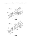 JAW CLOSURE DETECTION SYSTEM diagram and image