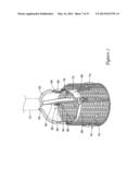 BOND BETWEEN COMPONENTS OF A MEDICAL DEVICE diagram and image