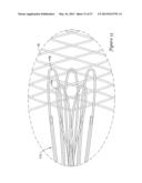 BOND BETWEEN COMPONENTS OF A MEDICAL DEVICE diagram and image