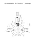 APPARATUS, SYSTEM, AND METHOD FOR ROBOTIC MICROSURGERY diagram and image