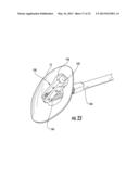 MEDICAL DEVICE FIXATION TOOL AND METHOD OF FIXATION OF A MEDICAL DEVICE diagram and image