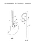 MEDICAL DEVICE FIXATION TOOL AND METHOD OF FIXATION OF A MEDICAL DEVICE diagram and image