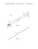 ARTHRODESIS IMPLANT AND BUTTRESSING APPARATUS AND METHOD diagram and image