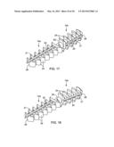 ARTHRODESIS IMPLANT AND BUTTRESSING APPARATUS AND METHOD diagram and image