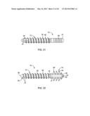 ARTHRODESIS IMPLANT AND BUTTRESSING APPARATUS AND METHOD diagram and image