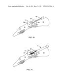 ARTHRODESIS IMPLANT AND BUTTRESSING APPARATUS AND METHOD diagram and image