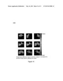 APPARATUS, SYSTEMS, COMPUTER-ACCESSIBLE MEDIUM AND METHODS FOR     FACILITATING RADIO FREQUENCY HYPERTHERMIA AND THERMAL CONTRAST IN A     MAGNETIC RESONANCE IMAGING SYSTEM diagram and image