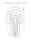 MEDICAL DEVICE WITH ONE OR MORE SHEATHING TRANSITION MEMBERS diagram and image