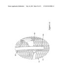 MEDICAL DEVICE WITH ONE OR MORE SHEATHING TRANSITION MEMBERS diagram and image