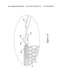 MEDICAL DEVICE WITH ONE OR MORE SHEATHING TRANSITION MEMBERS diagram and image