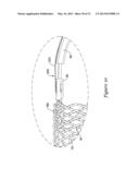 MEDICAL DEVICE WITH ONE OR MORE SHEATHING TRANSITION MEMBERS diagram and image