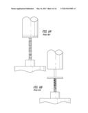 OFFSET PEAK-TO-PEAK STENT PATTERN diagram and image