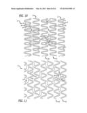 OFFSET PEAK-TO-PEAK STENT PATTERN diagram and image