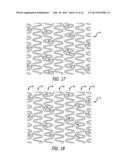 OFFSET PEAK-TO-PEAK STENT PATTERN diagram and image