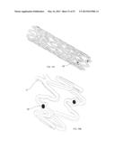 BIOABSORBABLE POLYMERIC MEDICAL DEVICE diagram and image