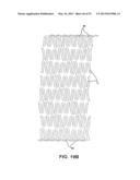 BIOABSORBABLE POLYMERIC MEDICAL DEVICE diagram and image