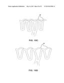 BIOABSORBABLE POLYMERIC MEDICAL DEVICE diagram and image