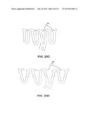 BIOABSORBABLE POLYMERIC MEDICAL DEVICE diagram and image