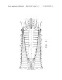 GAS TURBINE ENGINE LOCKOUT REDUCTION diagram and image