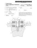 FUEL RAIL MOUNTING ARRANGEMENT diagram and image