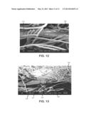 Nonwoven Composite Containing an Apertured Elastic Film diagram and image