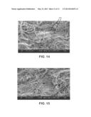 Nonwoven Composite Containing an Apertured Elastic Film diagram and image