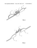 STAPLE AND FEEDER BELT CONFIGURATIONS FOR SURGICAL STAPLER diagram and image