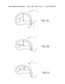 STAPLE AND FEEDER BELT CONFIGURATIONS FOR SURGICAL STAPLER diagram and image