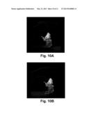 SMART PSEUDOSCOPIC-TO-ORTHOSCOPIC CONVERSION (SPOC) PROTOCOL FOR     THREE-DIMENSIONAL (3D) DISPLAY diagram and image