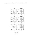 METHOD FOR IMAGE PROCESSING AND AN APPARATUS diagram and image