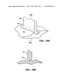 EXPANDABLE IMPELLER PUMP diagram and image