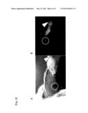 Fluorescent Probe for Imaging Lymph Nodes diagram and image