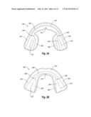 NON-CUSTOM DENTAL TREATMENT TRAYS HAVING IMPROVED ANATOMICAL FEATURES diagram and image