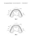 NON-CUSTOM DENTAL TREATMENT TRAYS HAVING IMPROVED ANATOMICAL FEATURES diagram and image