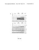 BIOMARKER FOR THE DIAGNOSIS, PROGNOSIS AND MONITORING OF CANCER diagram and image