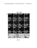 Compositions and Methods for Treating Pulmonary Conditions diagram and image