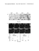 Compositions and Methods for Treating Pulmonary Conditions diagram and image