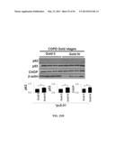 Compositions and Methods for Treating Pulmonary Conditions diagram and image