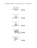 DOSIMETRICALLY CUSTOMIZABLE BRACHYTHERAPY CARRIERS AND METHODS THEREOF IN     THE TREATMENT OF TUMORS diagram and image