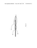 MEDICAL ASSEMBLY FOR DELIVERING AN IMPLANT diagram and image