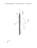 MEDICAL ASSEMBLY FOR DELIVERING AN IMPLANT diagram and image