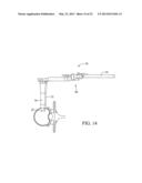 Surgical Access System and Related Methods diagram and image