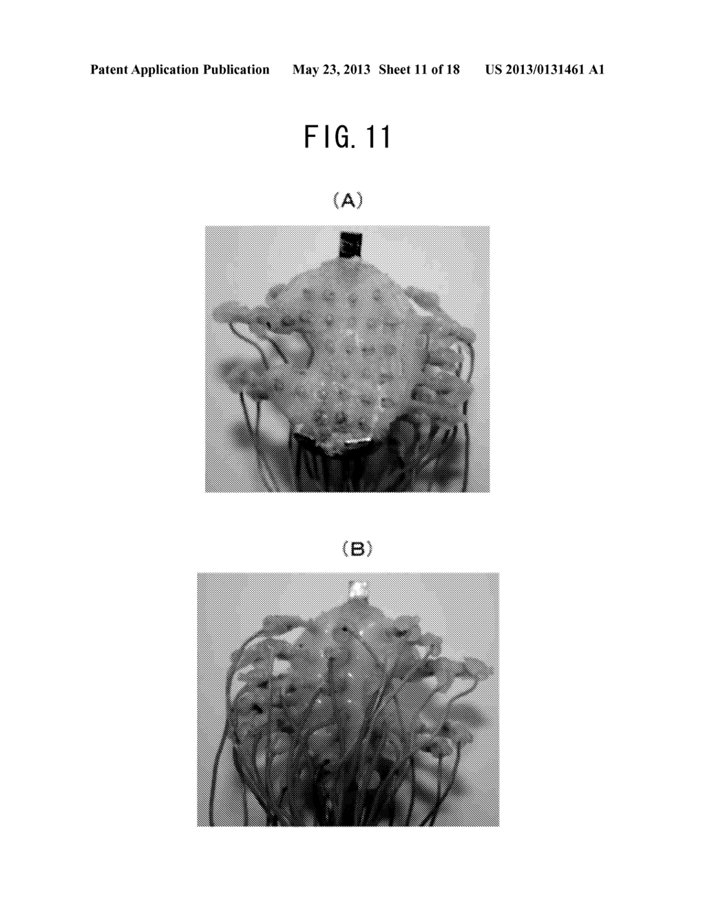 ELECTROENCEPHALOGRAM ELECTRODE UNIT FOR SMALL ANIMALS AND MEASUREMENT     SYSTEM USING THE SAME - diagram, schematic, and image 12