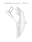 SYSTEMS, DEVICES, AND METHODS FOR IDENTIFYING PORTIONS OF A WOUND FILLER     LEFT AT A TISSUE SITE diagram and image