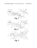 BLOOD VESSEL ACCESS SYSTEM AND DEVICE diagram and image